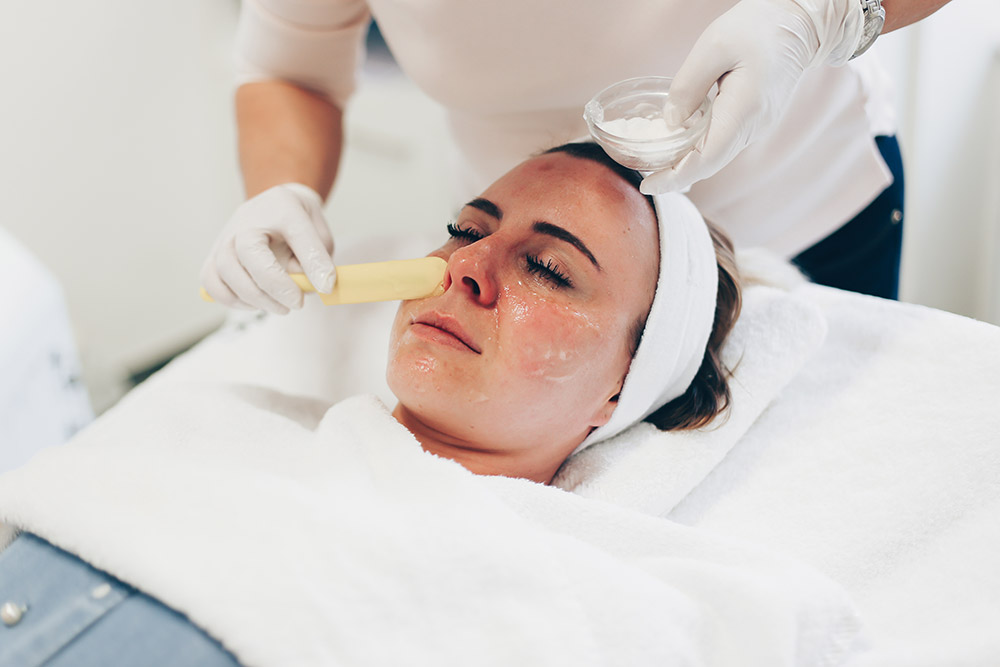 Behandlung von Gesichtsrötungen mit Laser, Rötungen im Gesicht, was hilft dagegen, Behandlung Kosmetikstudio, Laserbehandlung Gesicht, Beauty Blog, Erfahrungsbericht, Vorher Nachher Bilder, www.whoismocca.com