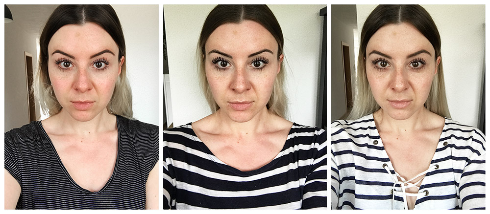 Gesichtsrötungen lasern: Meine Erfahrungen + Vorher-Nachher Bilder! 