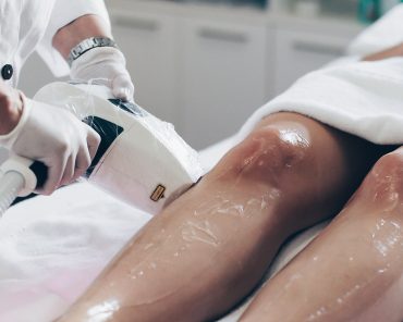 Dauerhafte Haarentfernung mit Laser? Ich habe es getestet! Dauerhafte Haarentfernung mit Laser? Ich habe es getestet!