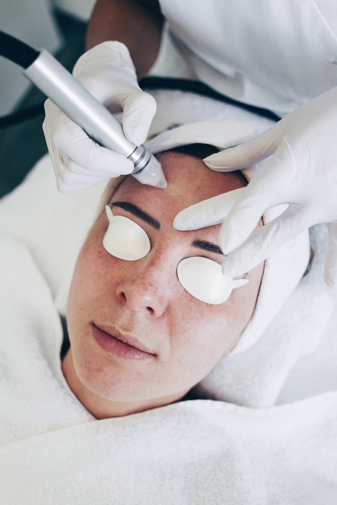 Microdermabrasion und Laserbehandlung für eine feinporige Haut! Life und Style Blog aus Österreich
